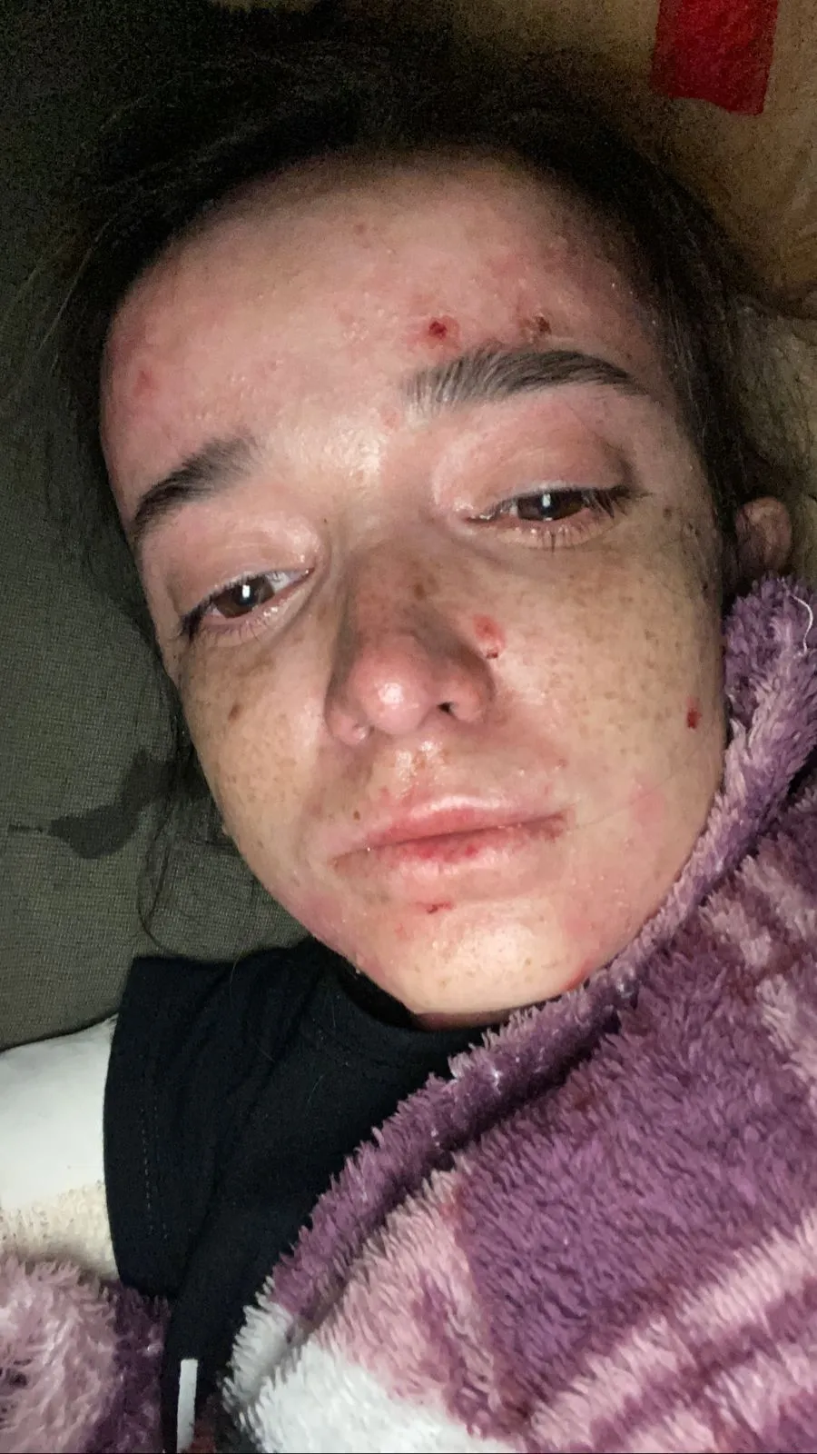 Close-up of Amara resting, showing wounds on her face
